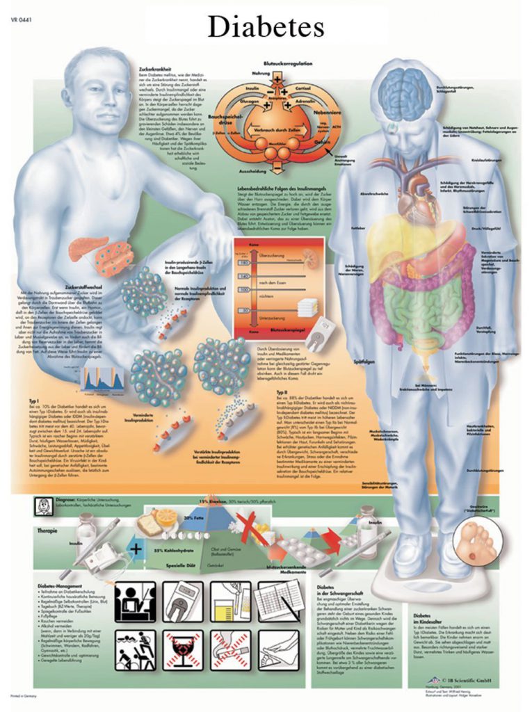 History Of Diabetes Mellitus ,- Diabetes Support Site